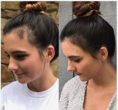 Postpartum Hair Loss Before and After Monat - Thrifty Brittany